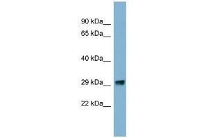 PRKRIP1 antibody used at 1 ug/ml to detect target protein.
