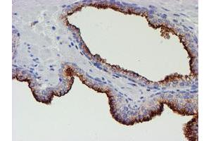 Image no. 1 for anti-Myocyte Enhancer Factor 2C (MEF2C) antibody (ABIN1499365)