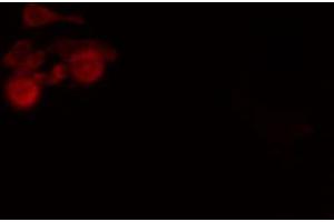 ABIN6274244 staining Hela cells by IF/ICC. (SOX6 anticorps  (N-Term))