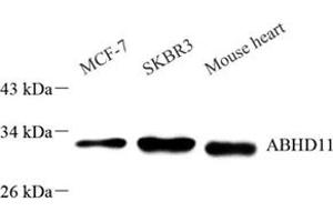 Western blot analysis of ABHD11 (ABIN7072873) at dilution of 1: 1000 (ABHD11 anticorps)