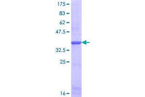 Image no. 1 for Collagen, Type I, alpha 2 (COL1A2) (AA 1257-1366) protein (GST tag) (ABIN1349948)