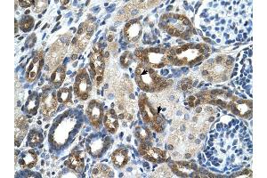 PKLR antibody was used for immunohistochemistry at a concentration of 4-8 ug/ml to stain Epithelial cells of renal tubule (arrows) in Human Kidney.