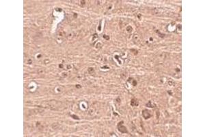 Immunohistochemistry of Gle1 in mouse brain tissue with Gle1 antibody at 2.