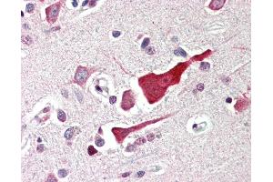 Anti-BCL2L10 / BCL-B antibody IHC of human brain, cortex. (BCL2L10 anticorps  (N-Term))