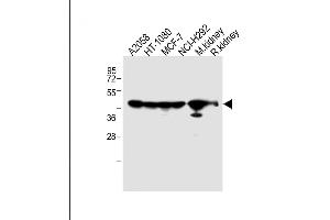 All lanes : Anti-P14 Antibody (N-term) at 1:2000 dilution Lane 1:  whole cell lysate Lane 2: HT-1080 whole cell lysate Lane 3: MCF-7 whole cell lysate Lane 4: NCI- whole cell lysate Lane 5: Mouse kidney lysate Lane 5: Rat kidney lysate Lysates/proteins at 20 μg per lane. (MMP14 anticorps  (N-Term))