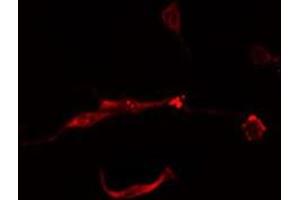 ABIN6277890 staining  Hela cells by IF/ICC. (FTH1 anticorps  (C-Term))