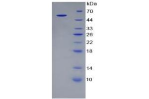 Alanine Aminotransferase (ALT) ELISA Kit