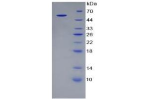 SDS-PAGE (SDS) image for Alanine Aminotransferase (ALT) ELISA Kit (ABIN6730944)