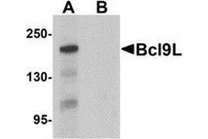Western blot analysis of Bcl9L in HeLa cell lysate with Bcl9L antibody at 1 μg/ml in (A) the absence and (B) the presence of blocking peptide. (BCL9L anticorps  (N-Term))