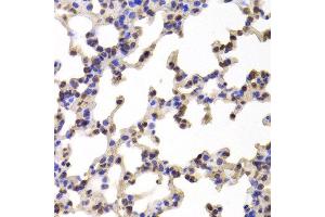 Immunohistochemistry of paraffin-embedded Mouse lung using C1R antibody at dilution of 1:100 (x400 lens). (C1R anticorps)