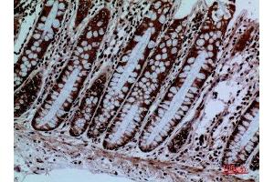Immunohistochemistry (IHC) analysis of paraffin-embedded Human Colon, antibody was diluted at 1:100. (PROC anticorps  (Internal Region))