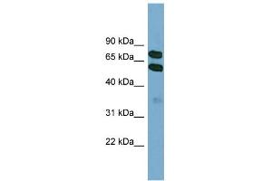 WB Suggested Anti-KLHL9 Antibody Titration: 0. (KLHL9 anticorps  (Middle Region))