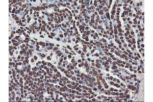 Image no. 12 for anti-F-Box Protein 21 (FBXO21) antibody (ABIN1498233) (FBXO21 anticorps)