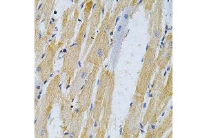Immunohistochemistry of paraffin-embedded rat heart using ADRBK1 Antibody.
