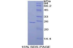 SDS-PAGE analysis of Rat FRS2 Protein.