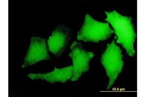 Immunofluorescence of monoclonal antibody to S100A2 on HeLa cell.