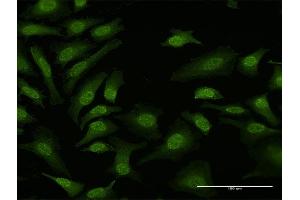 Immunofluorescence of purified MaxPab antibody to TPRKB on HeLa cell. (TPRKB anticorps  (AA 1-175))