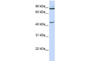 WB Suggested Anti-MCM9 Antibody Titration:  0. (MCM9 anticorps  (N-Term))
