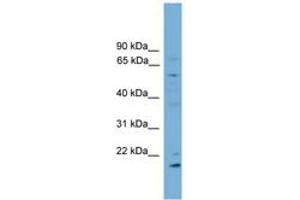 Image no. 1 for anti-Cytochrome P450, Family 2, Subfamily R, Polypeptide 1 (CYP2R1) (AA 179-228) antibody (ABIN6746310)
