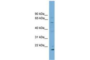 Image no. 1 for anti-Cytochrome P450, Family 2, Subfamily R, Polypeptide 1 (CYP2R1) (AA 179-228) antibody (ABIN6746310) (CYP2R1 anticorps  (AA 179-228))