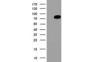 Western Blotting (WB) image for anti-Thimet Oligopeptidase 1 (THOP1) antibody (ABIN1501380) (Thimet Oligopeptidase 1 anticorps)