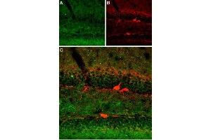 Expression of SERT in mouse brain - Immunohistochemical staining of immersion-fixed, free floating mouse brain frozen sections using Anti-Serotonin Transporter (SERT) (extracellular) Antibody (ABIN7043745, ABIN7044608 and ABIN7044609), (1:400).