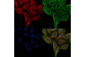 anti-G Protein-Coupled Receptor 142 (GPR142) (Internal Region) antibody