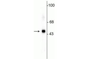 Western blot of HeLa lysate showing specific immunolabeling of the ~49 kDa SAP49 protein. (SF3B4 anticorps)