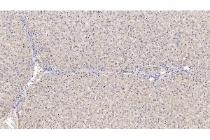 Detection of SERPINB4 in Human Liver Tissue using Monoclonal Antibody to Serpin Peptidase Inhibitor,Clade B,Member 4 (SERPINB4)
