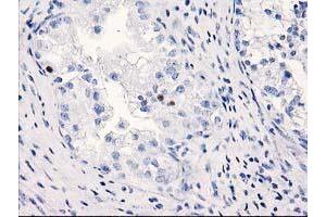 Immunohistochemistry (IHC) image for anti-Chromosome 1 Open Reading Frame 50 (C1ORF50) antibody (ABIN1497032) (C1ORF50 anticorps)