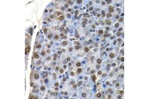 Immunohistochemistry of paraffin-embedded mouse pancreas using ID3 antibody (ABIN6130481, ABIN6142140, ABIN6142141 and ABIN6221020) at dilution of 1:200 (40x lens). (ID3 anticorps  (AA 1-119))