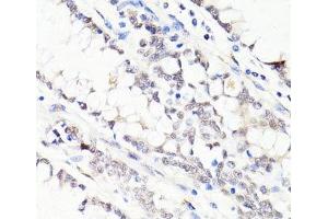 Immunohistochemistry of paraffin-embedded Human colon using FKBP5 Polyclonal Antibody at dilution of 1:100 (40x lens). (FKBP5 anticorps)