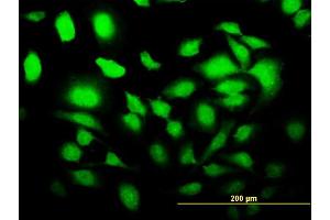 anti-SLC2A4 Regulator (SLC2A4RG) (AA 178-269) antibody