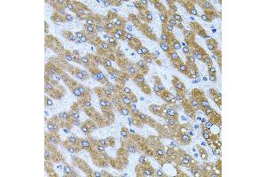 Immunohistochemistry of paraffin-embedded human liver injury using CPM antibody at dilution of 1:100 (x40 lens).