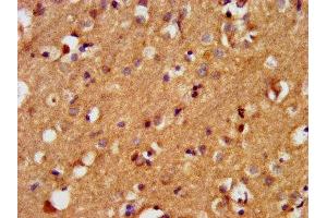 IHC image of ABIN7145227 diluted at 1:400 and staining in paraffin-embedded human brain tissue performed on a Leica BondTM system. (BAIAP3 anticorps  (AA 131-257))
