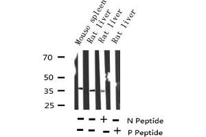 Western blot analysis of Phospho-I kappaB epsilon (Ser22) expression in various lysates (NFKBIE anticorps  (pSer161))