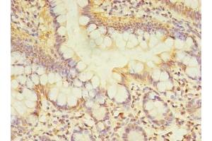 Immunohistochemistry of paraffin-embedded human small intestine tissue using ABIN7171449 at dilution of 1:100 (TCP11L2 anticorps  (AA 1-210))