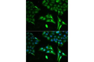Immunofluorescence analysis of U2OS cells using ACADS antibody. (ACADS anticorps)