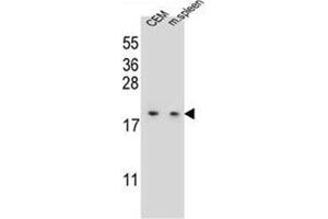 Western blot analysis of LSM7 Antibody (C-term) in CEM cell line and mouse spleen tissue lysates (35ug/lane).