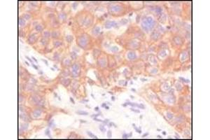 Immunohistochemistry (IHC) image for anti-Keratin 1 (KRT1) (truncated) antibody (ABIN2464043)