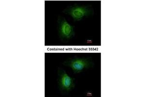 ICC/IF Image Immunofluorescence analysis of methanol-fixed HeLa, using Cytochrome P450 1B1, antibody at 1:200 dilution.
