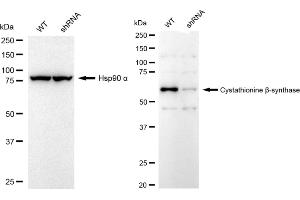 Western blotting analysis using Cystathionine beta-synthase antibody (ABIN7798235).