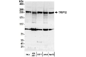 anti-Thyroid Hormone Receptor Interactor 12 (TRIP12) (AA 75-125) antibody