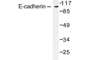 Image no. 1 for anti-Cadherin 1, Type 1, E-Cadherin (Epithelial) (CDH1) antibody (ABIN265391) (E-cadherin anticorps)