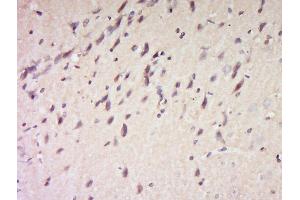 Formalin-fixed and paraffin embedded rat brain labeled with Anti-Bcl-2 alpha Polyclonal Antibody, Unconjugated  at 1:200 followed by conjugation to the secondary antibody and DAB staining. (Bcl-2 anticorps  (AA 51-150))