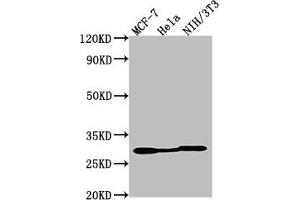 Western Blot Positive WB detected in: MCF-7 whole cell lysate, Hela whole cell lysate, NIH/3T3 whole cell lysate All lanes: LGALS3 antibody at 1:2000 Secondary Goat polyclonal to Mouse IgG at 1/50000 dilution Predicted band size: 27 kDa Observed band size: 27 kDa (Galectin 3 anticorps)
