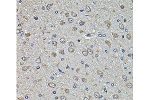 Immunohistochemistry of paraffin-embedded Rat brain using EPHA3 Polyclonal Antibody at dilution of 1:100 (40x lens). (EPH Receptor A3 anticorps)