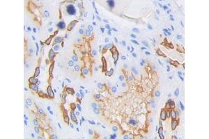 Used in DAB staining on fromalin fixed paraffin- embedded kidney tissue (HAVCR1 anticorps  (AA 21-240))