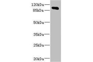 Western blot All lanes: MAP4K5 antibody at 4. (MAP4K5 anticorps  (AA 300-480))