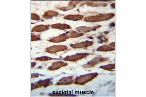 anti-Ubiquitin Specific Peptidase 45 (USP45) (AA 309-338) antibody